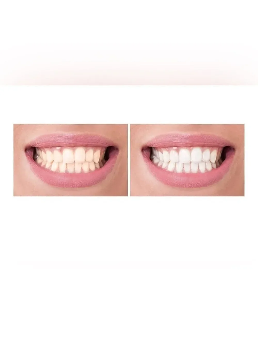 Smile Sciences Teeth Whitening Pens Peppermint Flavor Set of 2 New In Box